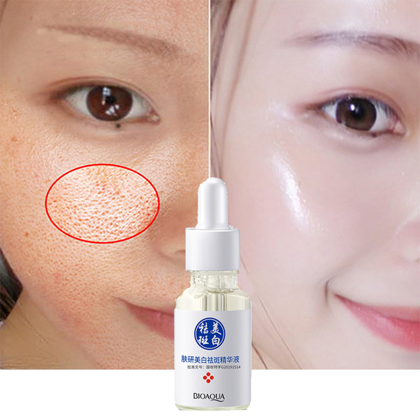 Serum Làm Trắng Da Mặt Tàn Nhang Kem Điều Chỉnh Vết Thâm Loại Bỏ Mạnh Mẽ Nám Melanin Thâm Đốm Dưỡng Ẩm Làm Sáng Da Dưỡng Ẩm Chăm Sóc Da 15Ml