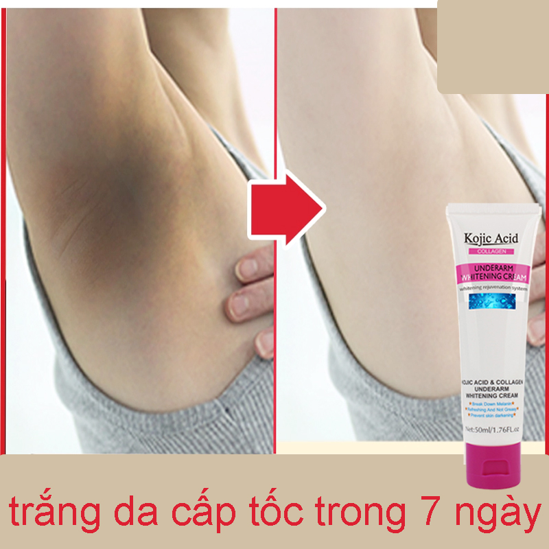 Kem dưỡng trắng da giảm thâm nách khử mùi làm sáng da body cấp Whitening Underarm Moisturizing Lotion Body Cream. Làm trắng và khử mùi hôi nách, trị thâm nách, thâm đầu gối, khuỷu tay.
