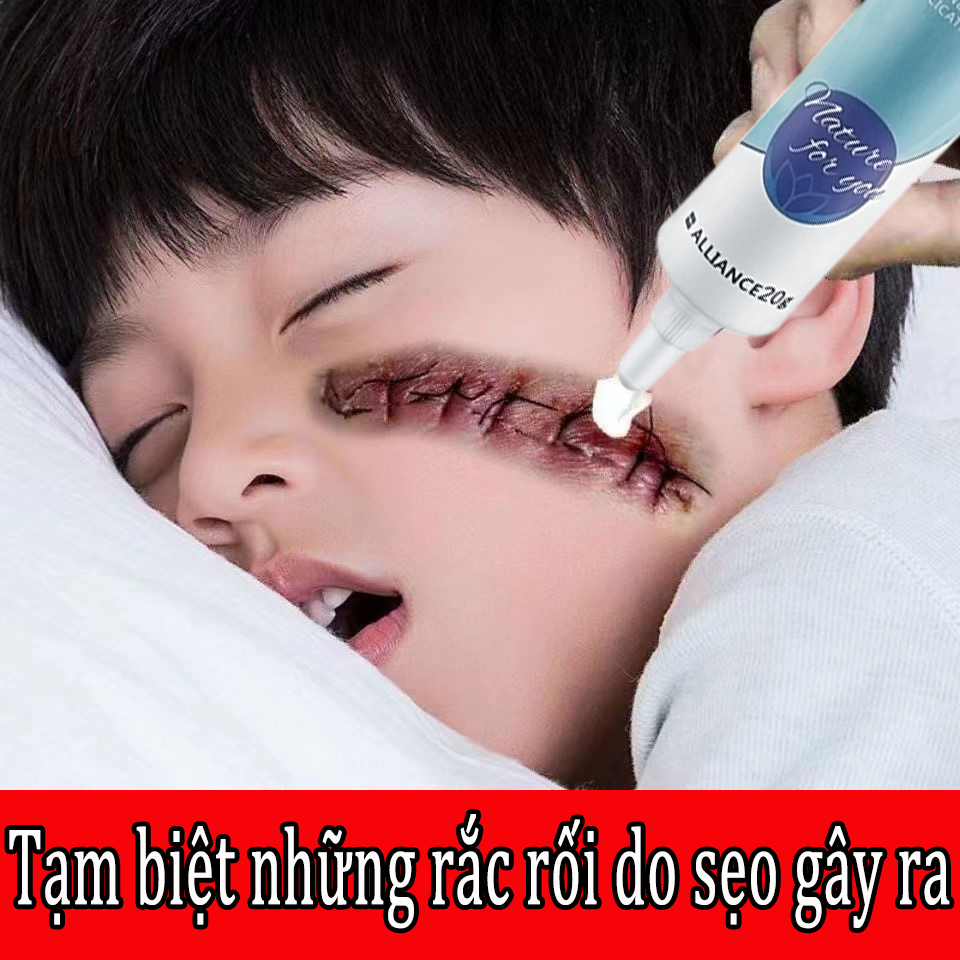 Kem che sẹo，các loại sẹo khác nhau làm mờ sẹo kem sẹo Xóa sẹo nhanh chóng mờ sẹo thâm mụn,mờ thâm ,vết rạn da tăng sản sẹo, làm mờ sẹo thâm, hiệu quả nhanh chóng