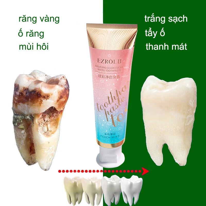 Kem Đánh Răng Loại bỏ ố răng trắng răng Làm trắng sạch răng cảm giác mát dịu kem Đánh Răng Hơi thở thơm mát kem đánh răng Đào bạc hà làm trắng sạch răng nhiều màu 100g