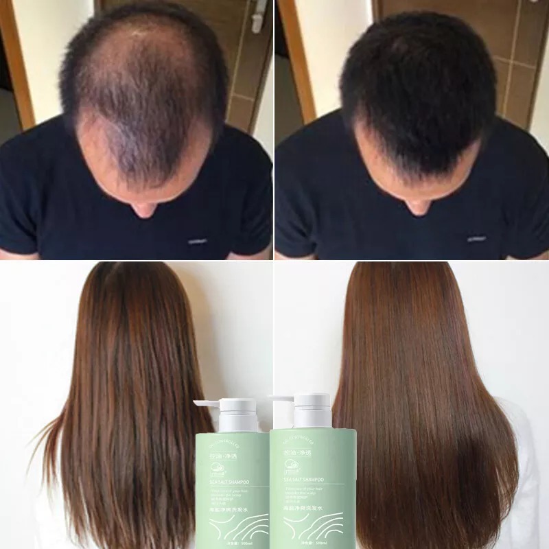 Mua 2 Tặng 1 Dầu gội muối biển Kiểm soát dầu gội Fluffy Dầu gội sạch Axit amin Chăm sóc da đầu Chăm sóc