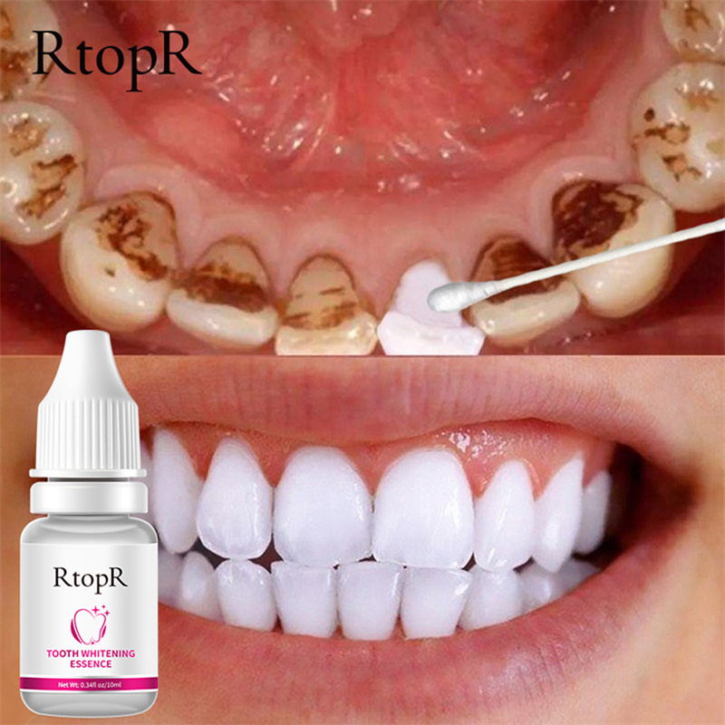Rtopr răng làm trắng tinh chất loại bỏ mảng bám vết bẩn vệ sinh răng miệng