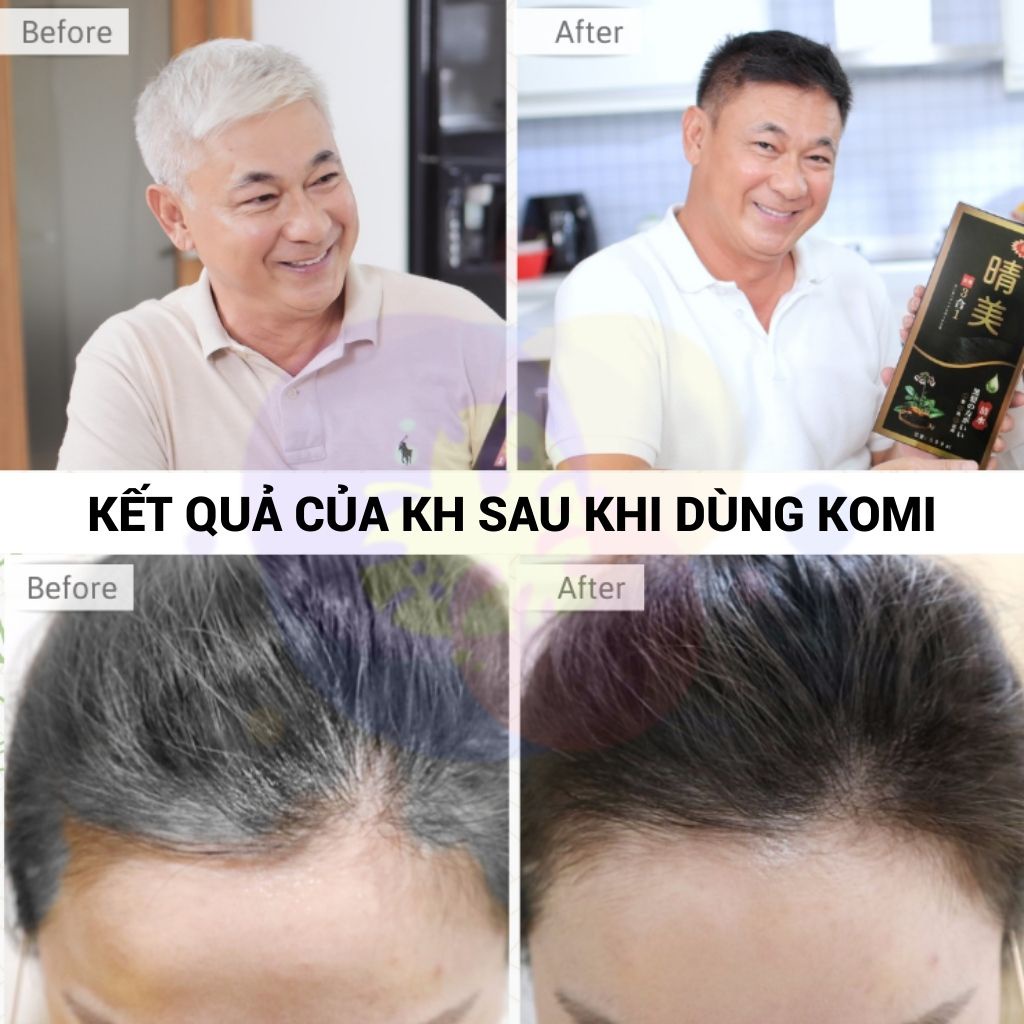 Dầu gội phủ bạc Komi Nhật Bản nhuộm tóc ĐEN/NÂU thảo dược thiên nhiên 500ml/1chai