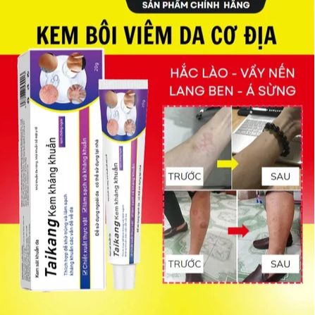 [ kem taikang ] Kem bôi nấm ngứa vảy nến á sừng ghẻ nước tổ đỉa1231