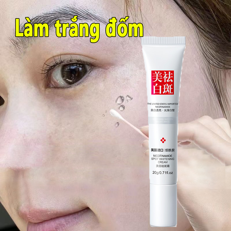 Kem trị nám tàn nhang làn da trắng sáng tự tin kem nám tàn nhang 40g