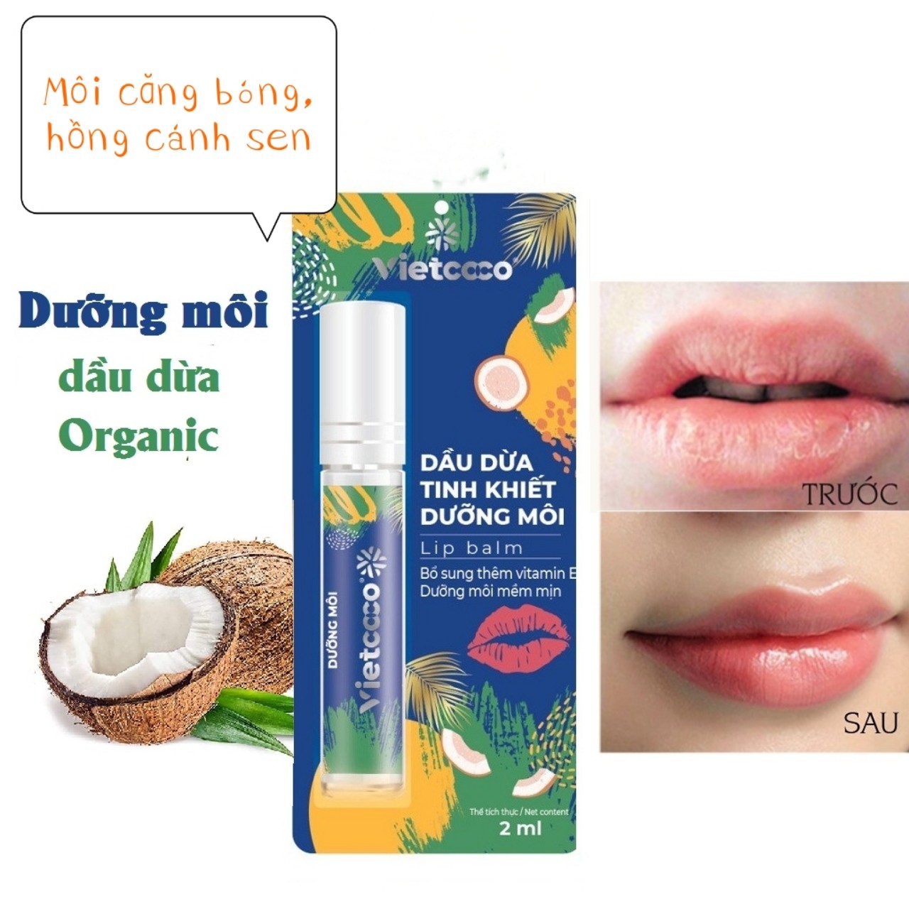Dưỡng môi Son Vietcoco làm hồng giảm thâm, hết nhăn hết khô môi căng bóng an toàn cho bà bầu, bà mẹ cho em bé bú