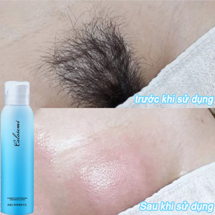 Kem Tẩy Lông Kem tẩy lông vĩnh viến xịt tẩy lông nhanh chóng xịt tẩy lông ,tẩy lông vùng nách, chân, tay, vùng kín Xịt tẩy lông nhanh chóng, hiệu quả150g