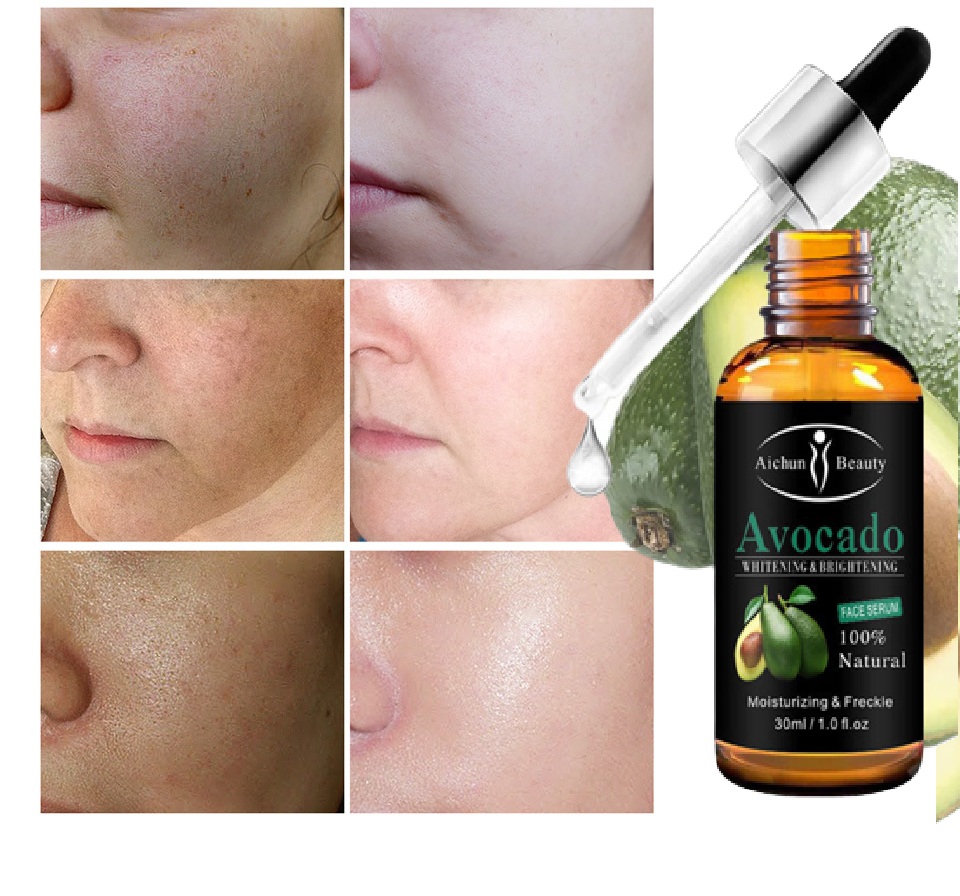 Serum Bơ Aichum Beauty dưỡng trắng da Mờ Nám giúp tái tạo da mặt làm sáng và căng bóng, ngăn ngừa lão hóa da chống thâm mắt và bọng mắt