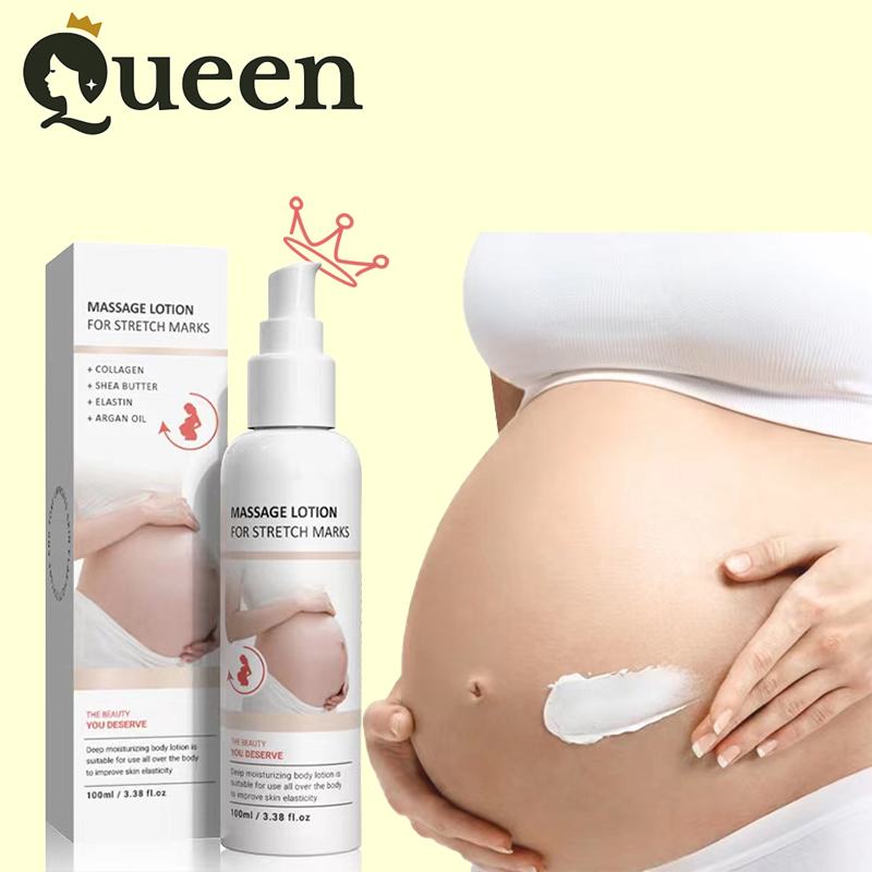 Kem dưỡng da rạn da QEM 100ml kem mờ vết rạn da kem giảm vết rạn da