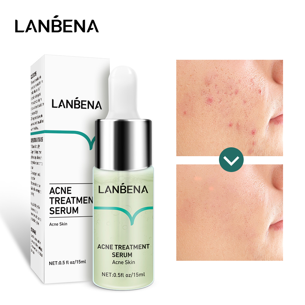 LANBENA Tinh chất trị mụn, thu nhỏ lỗ chân lông, dưỡng ẩm và phục hồi da có dung tích 15ml - INTL