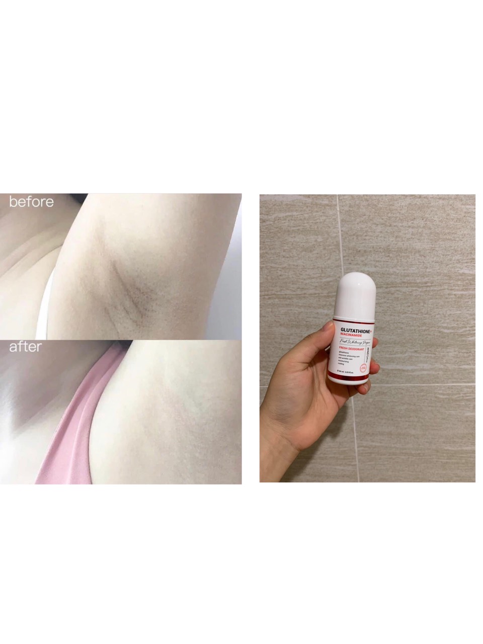 GLUTATHIONE - LĂN NÁCH GLUTATHIONE - TRI THÂM - DƯỠNG TRẮNG - KHỬ MÙI