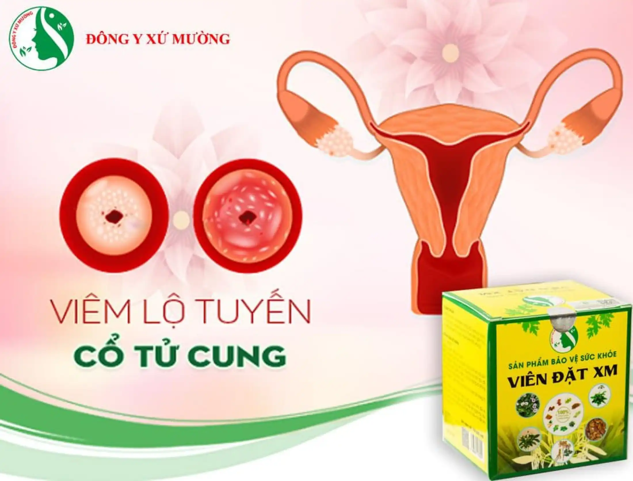 Viên Đặt XM