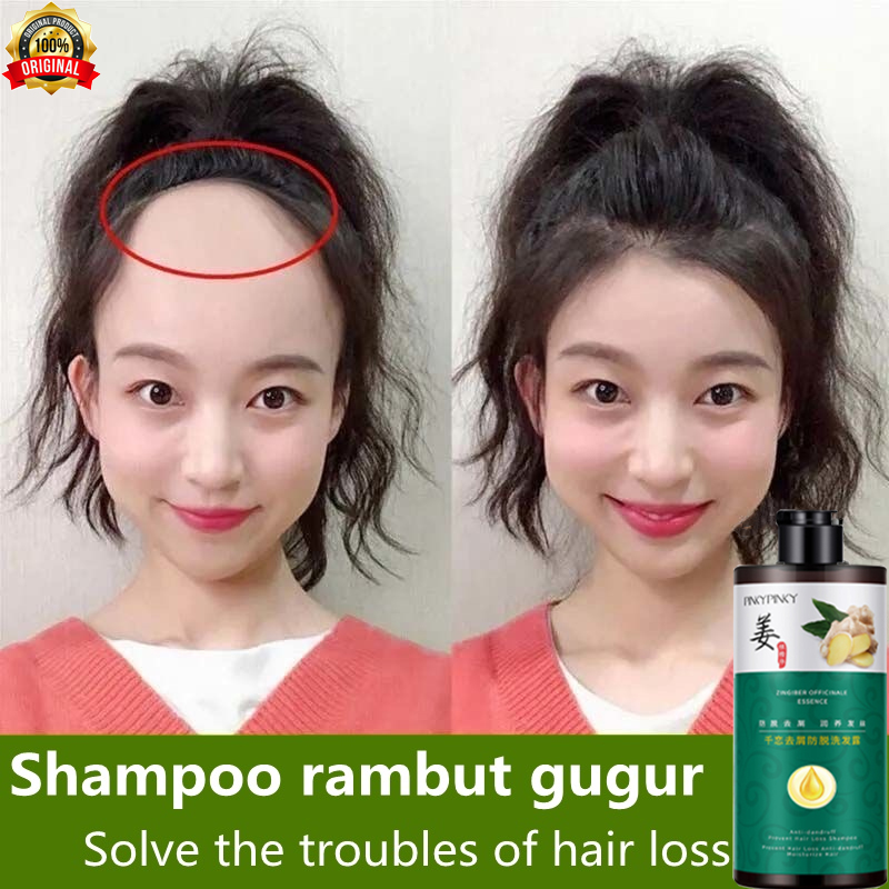 mọc tóc nhanh dưỡng tóc cấy tóc rụng tóc sau sinh dầu gội đầu Chiết xuất thực vật  nuôi dưỡng củng cố chân ginger shampoo 400 ML tóc và ổn định tóc sữa gội đầu chống rụng tóc Dầu gội  gàu và giảm rụng Rụng tóc bắt đầ