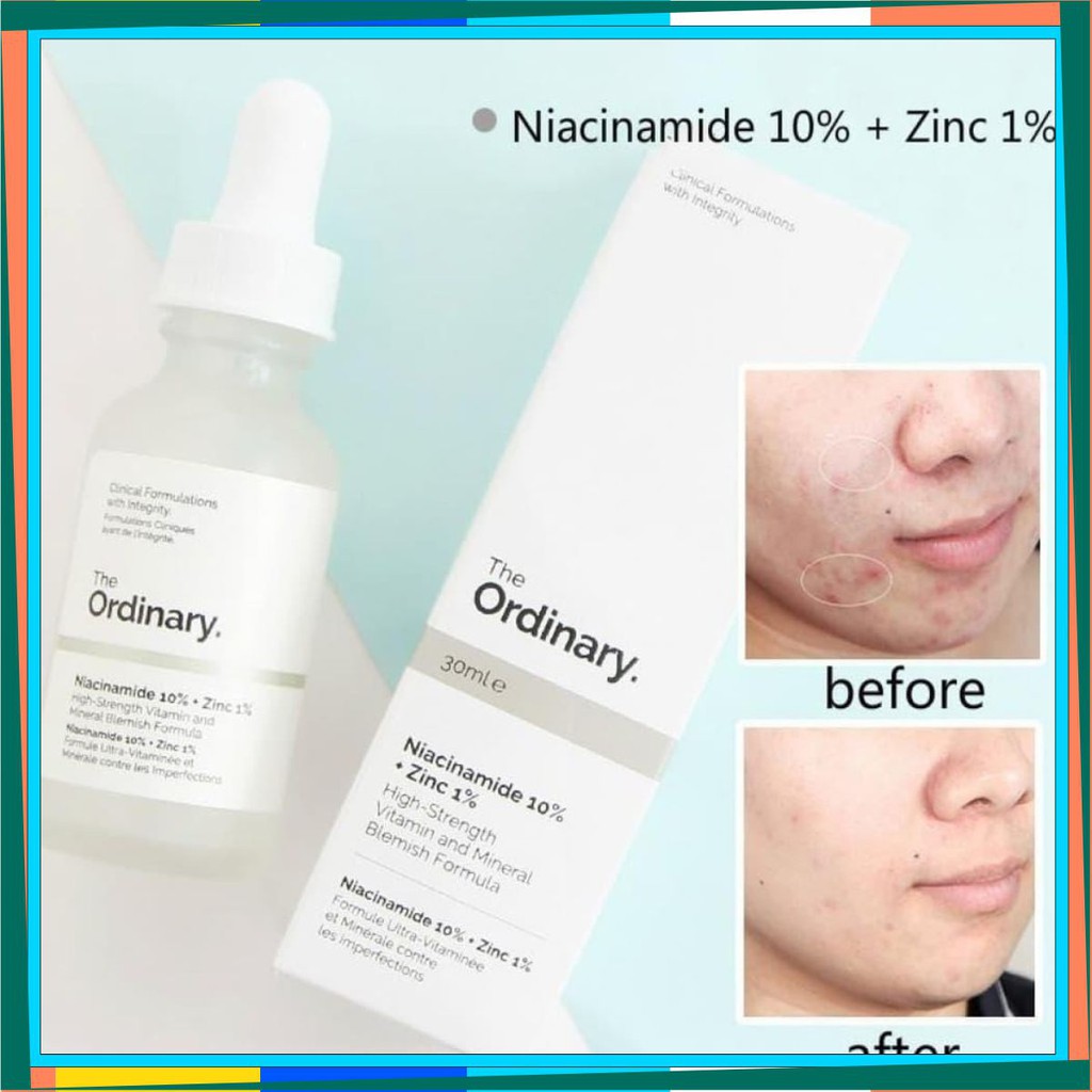 Serum Niacinamide 10% + Zinc 1% The Ordinary - Tinh Chất The Ordinary kiềm dầu giảm mụn giảm thâm
