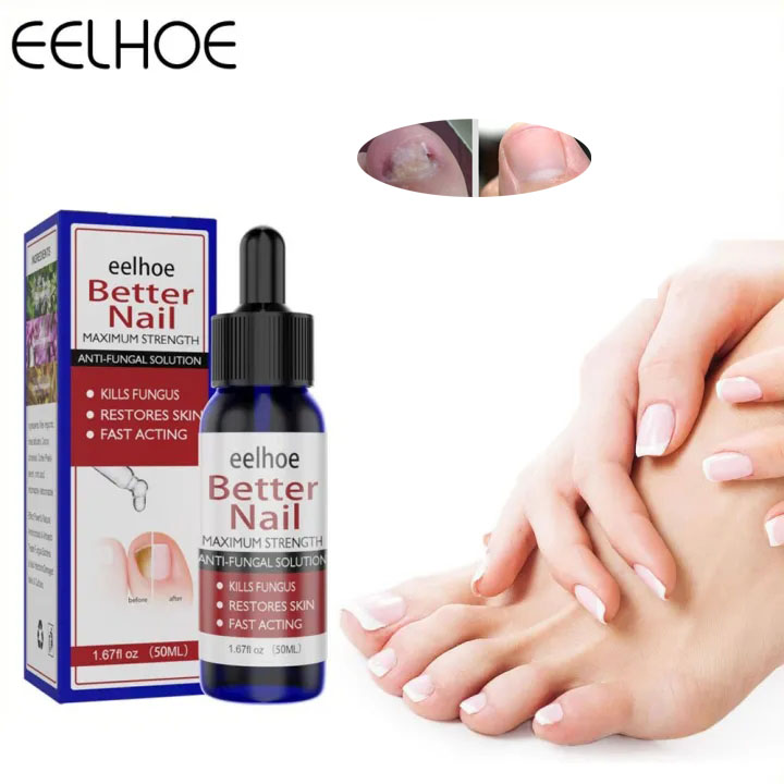 Serum sửa chữa móng tay nấm móng Loại bỏ nấm móng Dưỡng móng Chăm sóc tay và chân 50ml tay chân loại bỏ nấm móng tay