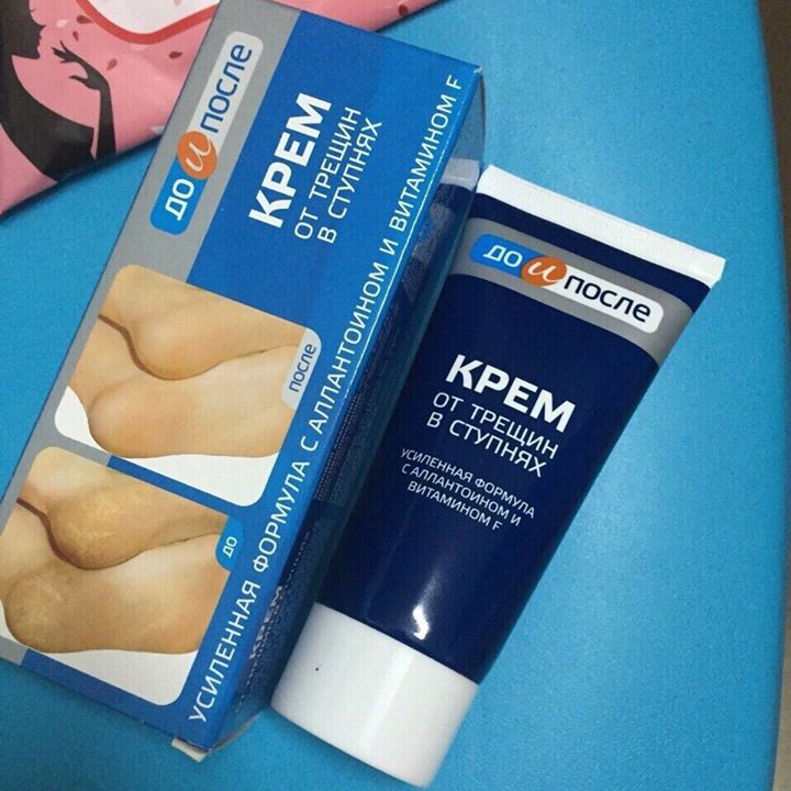 Kem nga kpem