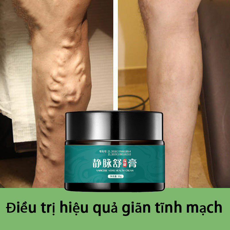 Các loại thảo mộc tự nhiên làm dịu tĩnh mạch 30g có hiệu quả làm giảm giãn tĩnh mạch, giảm giãn tĩnh mạch nhện, giun đất chân, viêm mạch máu, viêm tĩnh mạch, giảm đau tĩnh mạch phù chân