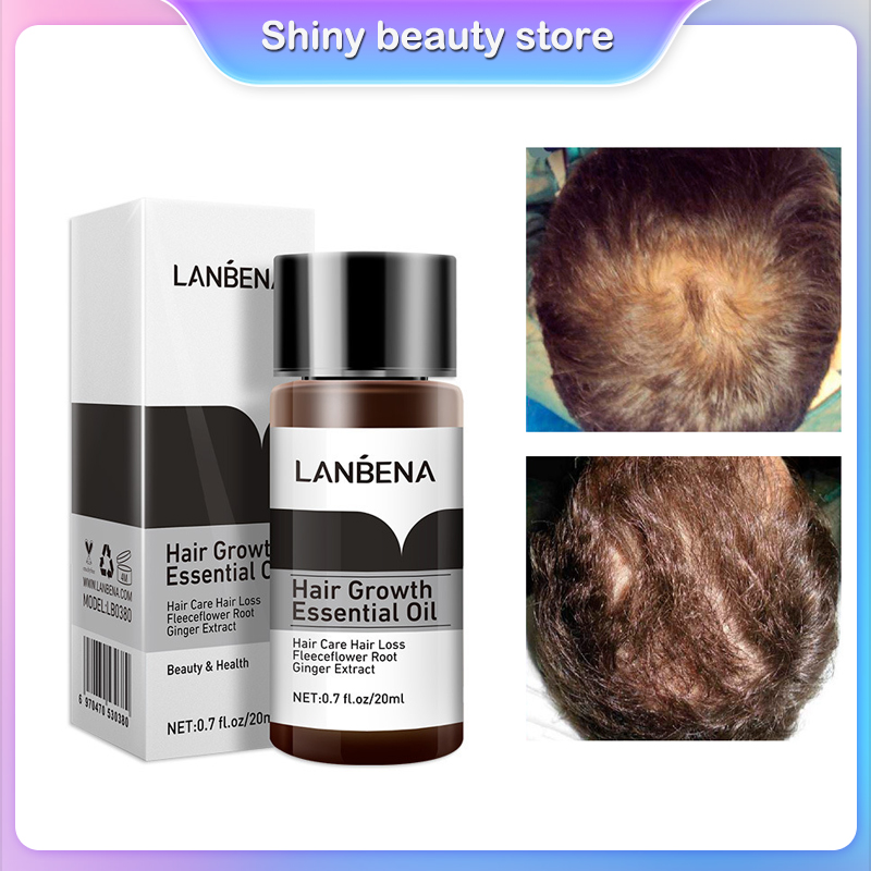 Lanbena tinh chất huyết mọc tóc tinh chất kích thích mọc tóc chăm sóc tóc chăm sóc tóc chuyên sâu mọc tóc kích thích mọc tóc hair growth oil 20ml
