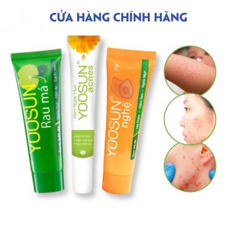 Kem yoosun rau má - yoosun acnes - yoosun nghệ