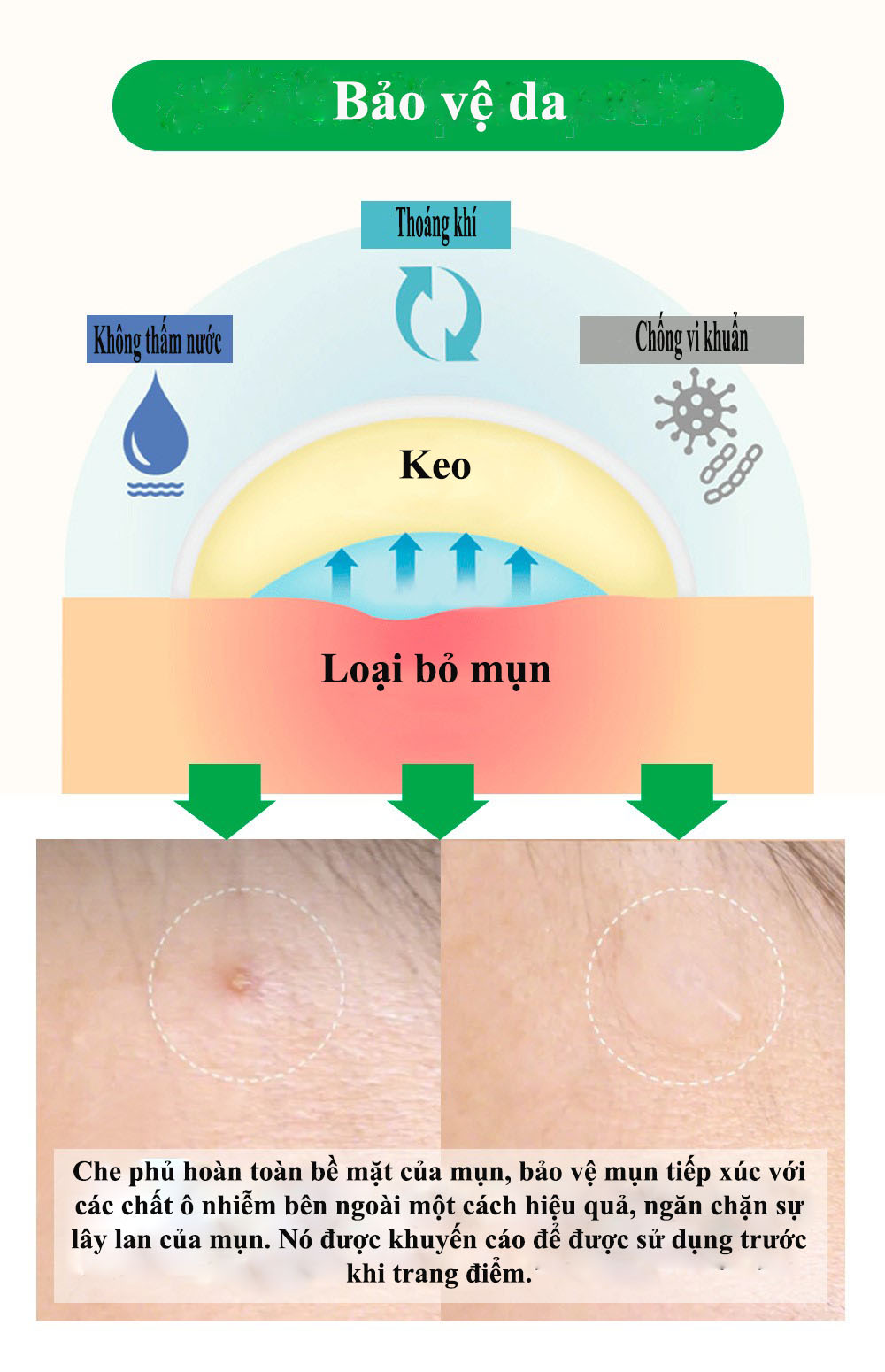 BREYLEE Miếng Dán Tri Mụn Đầu Đen Tri Thâm Mụn Trứng Cá Lột Mụn Đậu Đen Làm Mờ Vết Thâm Do Mụn (Dùng Cho Buổi Tối) FACIAL MASK 22 PATCHES NIGHT USE ACNE PIMPLE PATCH 5