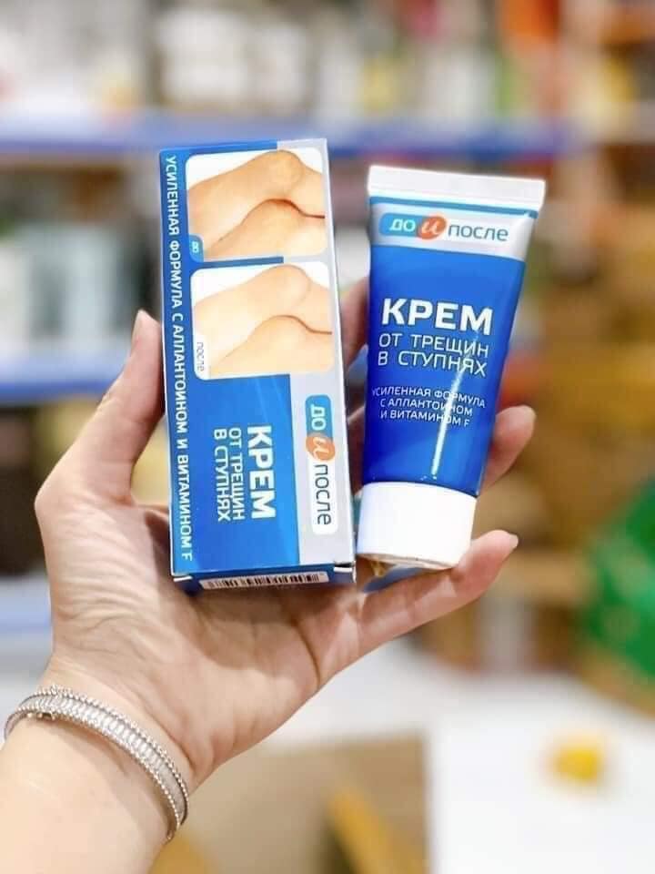 Kem trị nứt gót chân kpem apteka nga - date 2025