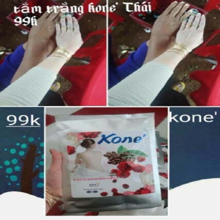 Tắm trắng kone