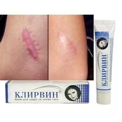 Mờ sẹo Nga Klirvin hiệu quả tức thì