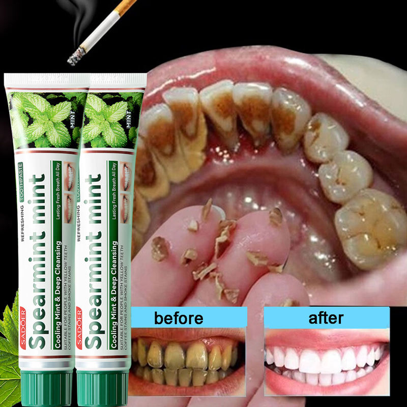 Bảo vệ răng chắc khỏe Kem Đánh Răng Dạng Gel Vệ Sinh Răng Miệng