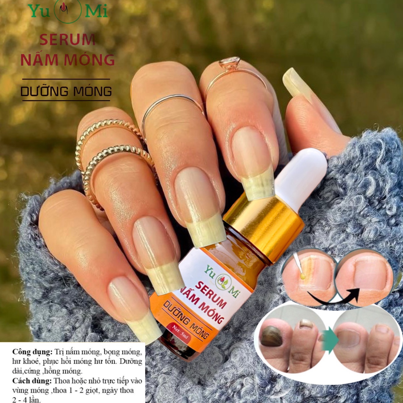 Serum nấm móng tay chân, đánh bay nấm móng, hư khoé, bọng móng, viêm móng nhé