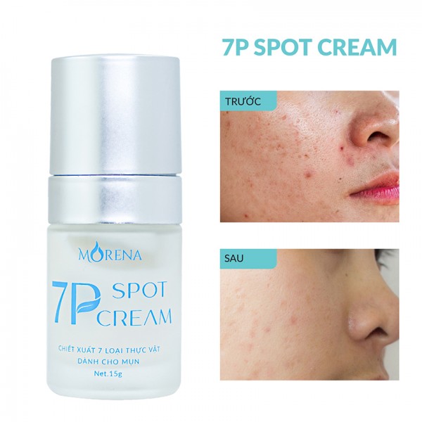 Kem chấm mụn 7P Spot Cream Huyền Phi chính hãng