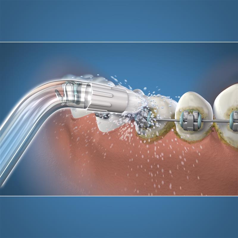 Đầu phun máy tăm nước cho răng niềng Waterpik OD-100E