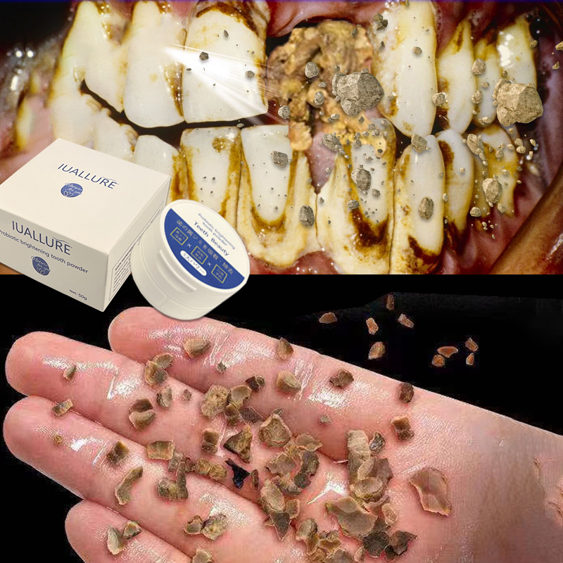 [local delivery]Tẩy trắng răng,Bột Ngọc trai trắng răng 50g kem đánh răng trắng răng(new)，Hết Xỉn Ố Cao Răng Giúp Răng Giảm Ố Vàng răng ê buốt