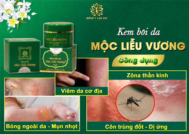 [HCM]Kem bôi da Mộc Liễu Vương Lan Chi - khắc tinh của bệnh da liễu