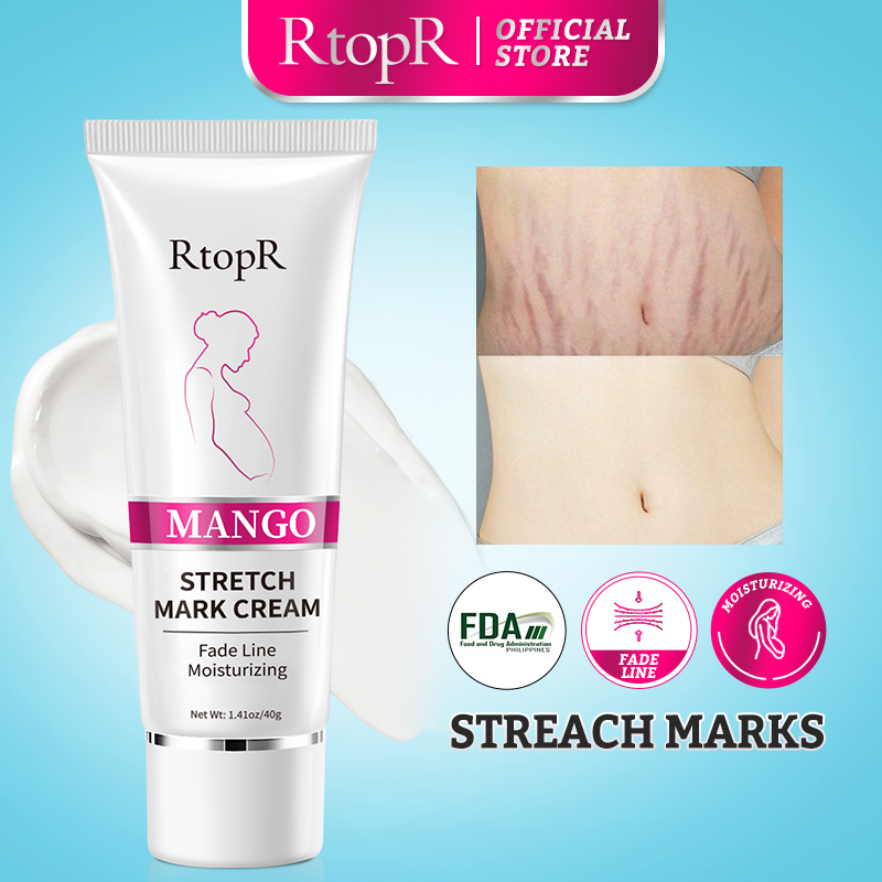 RtopR Kem xoài rạn da cho phụ nữ mang thai loại bỏ sẹo chống lão hóa làm săn chắc da - INTL
