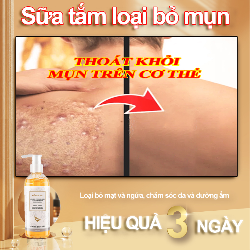 sữa tắm dưỡng ẩm sữa tắm loại bỏ mụn Sữa tắm làm trắng da 260ml Tẩy tế bào chết toàn tắm trắng trắng da thân da toàn thân sữa thể sữa dưỡng thể sữa tắm nước hoa hiệu quả dài lâu dưỡng ẩm làm mịn da loại bỏ mụn mạt