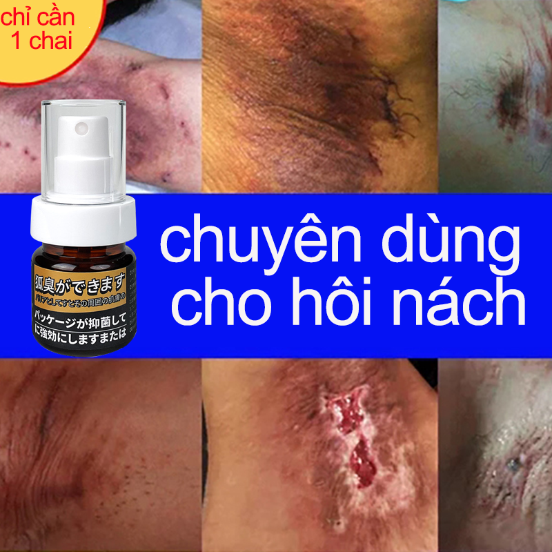 Dung dịch khử mùi hôi nách xịt khử mùi hôi nách 35ml khử mùi cơ thể khử mùi hôi nách sâu