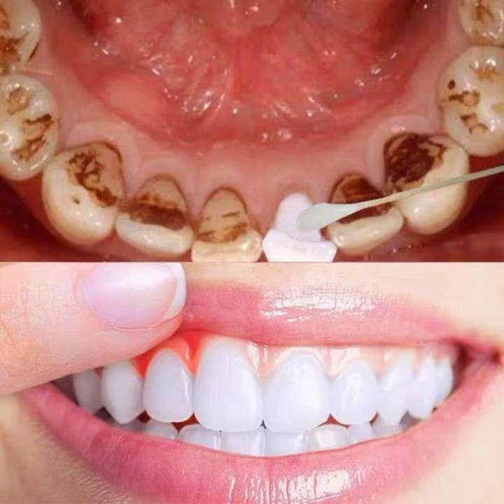 Kem đánh răngTinh chất làm trắng răng ,bột trắng răng nhanh chóng,vệ sinh răng miệng,loại bỏ vết bẩn nhanh,răng ố vàng