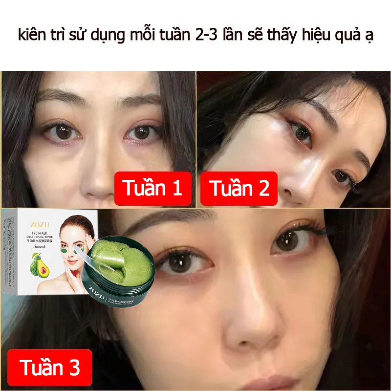 60 miếng mặt nạ mắt quầng thâm zozu trái bơ giảm thâm mắt chống nhăn vùng mắt làm dịu và giúp thư giãn da vùng mắt đang mệt mỏi giảm sưng giảm bọng mắt