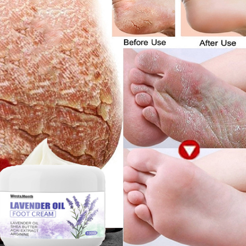 Kem dưỡng da chân oa oải hương 100g kem nứt gót chân dưỡng ẩm chân dưỡng ẩm mịn da xóa nứt gót chân - nẻ da tay