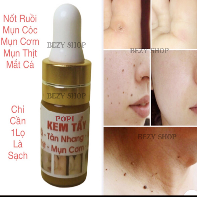 [HCM]Kem Xóa Nốt Ruồi Tàn Nhang Đồi Mồi