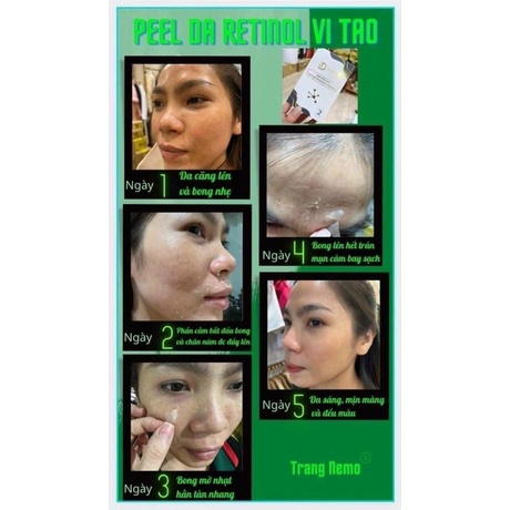 Tinh chất vi tảo tái tạo da skin peeling & skin revitalizing essence mo&mm