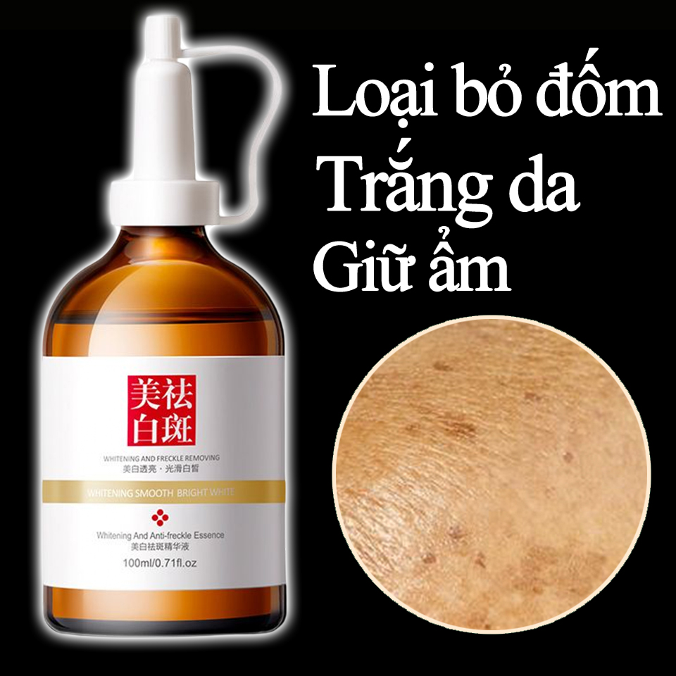 Mỹ phẩm nữ kem xóa nám Serum chuyên sâu nám tàn nhang serum sáng da nhanh 100g giúp hết mụn, thâm, nám tàn nhang, se khít lỗ chân lông, làm trắng da, tàn nhang nhanh chóng dưỡng da xóa mờ thâm nám tàn nhang hiệu quả