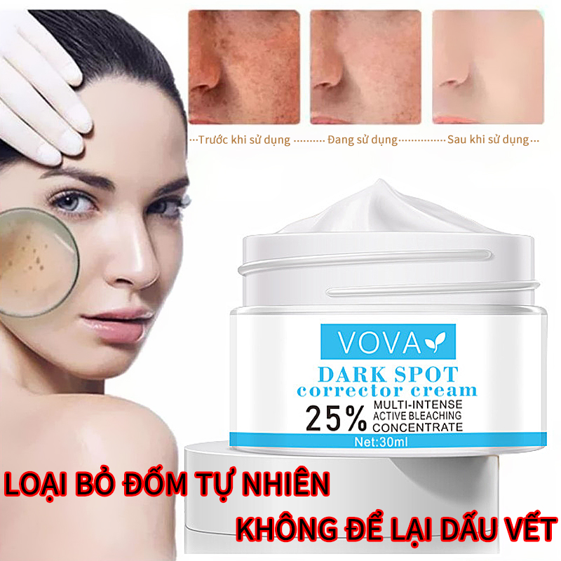 VOVA Kem làm mờ vết thâm Kem xóa vết thâm Kem làm sáng da chống lão hóa