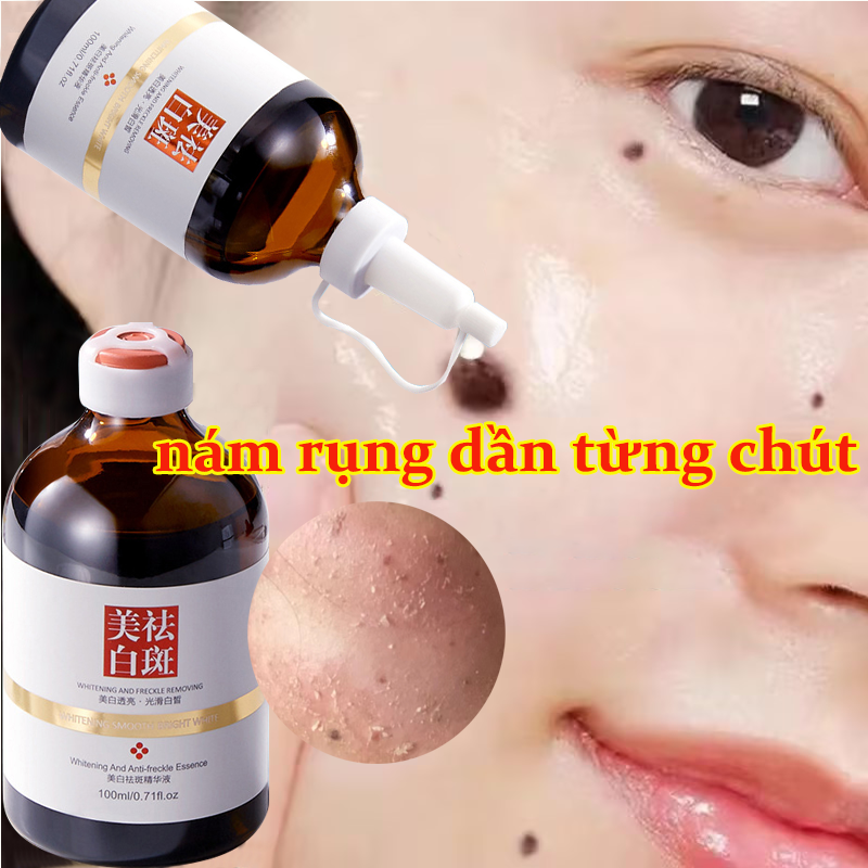 Kem Xoá Nám Nám Tàn Nhang Tinh chất làm trắng sạch tàn nhang Kem trắng da và xóa tàn nhang Kem xóa tàn nhang đồi mồi Hiệu quả làm mờ thâm nám tàn nhan kem thâm nám tàn nhang đồi mồi Dưỡng Ẩm Làm Trắng Da