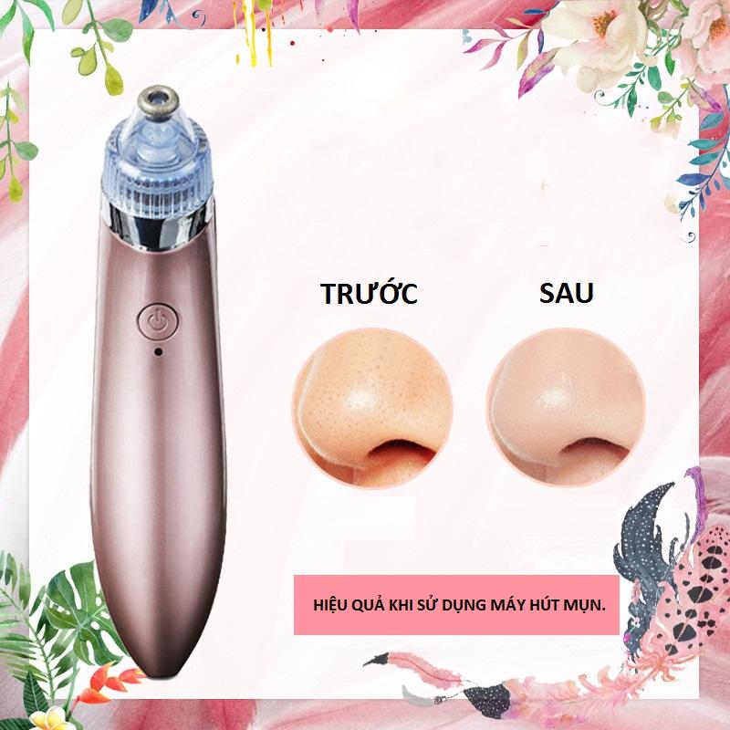 Máy Hút Mụn Trứng Cá Cầm Tay Mini Cao Cấp An Toàn Cho Da Mụn, Hút Sạch Các Loại Mụn Trả Lại Cho Bạn Làn Da Mịn Màng Cho Chàng Và Nàng Thêm Yêu / Bảo Hành 1 Đổi 1