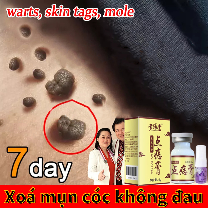 Kem loại bỏ mụn cóc đậm đặc ￼kem dưỡng da phân tử loại bỏ mụn cóc đầu nhọn eugene thorn / apgardrug warts đậm đặc