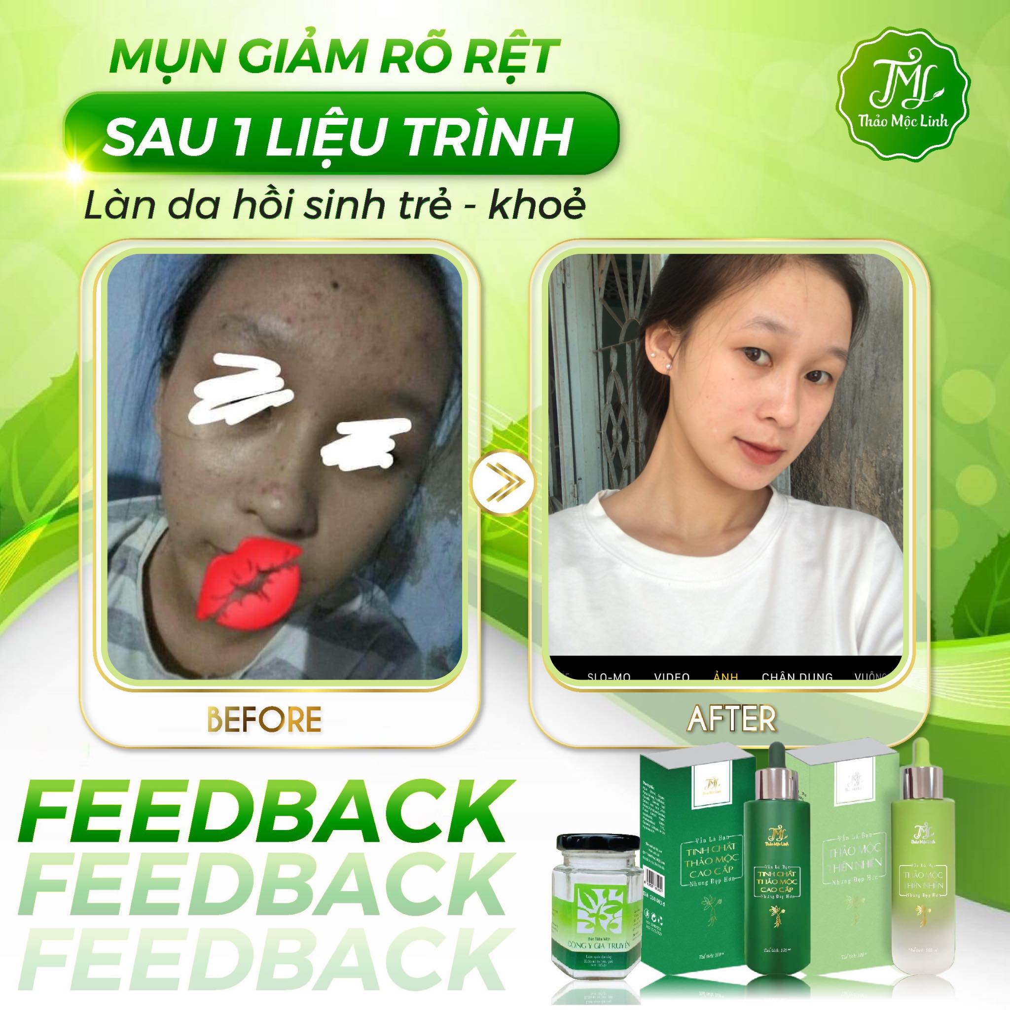 Bộ chính hãng Đông y gia truyền Thảo Mộc Linh  và Bột rửa mặt thảo mộc linh