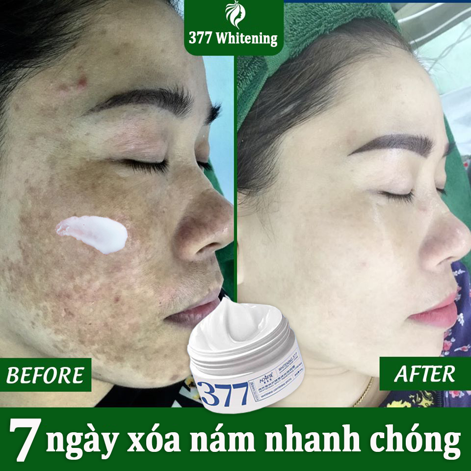 Kem trắng da mặt 50g Kem tri nam Giúp Dưỡng trắng Xóa sạch nám Kem dưỡng trắng da mặt