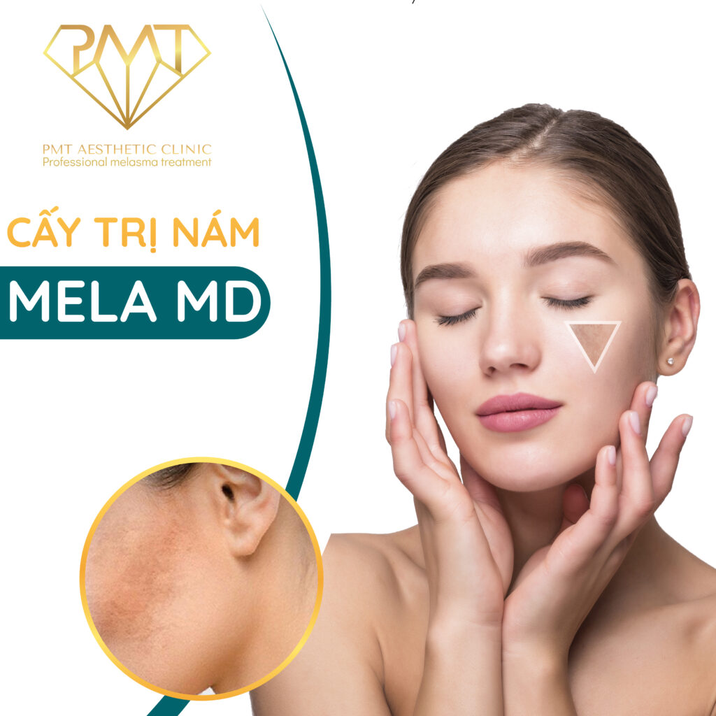 [Evoucher dành cho da nám] Cấy Mela MD - Bác sĩ Phạm Minh Trường