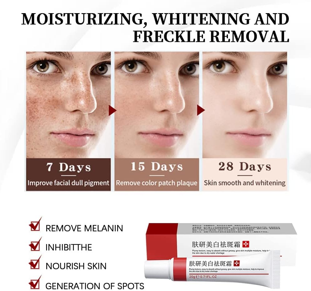 Spot Whitening Herbal Freckle Cream Effective Freckle Corrector Cream Dark Spot Corrector Cream